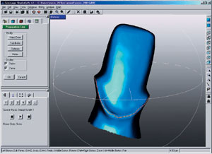 Zahnersatz in 3-D